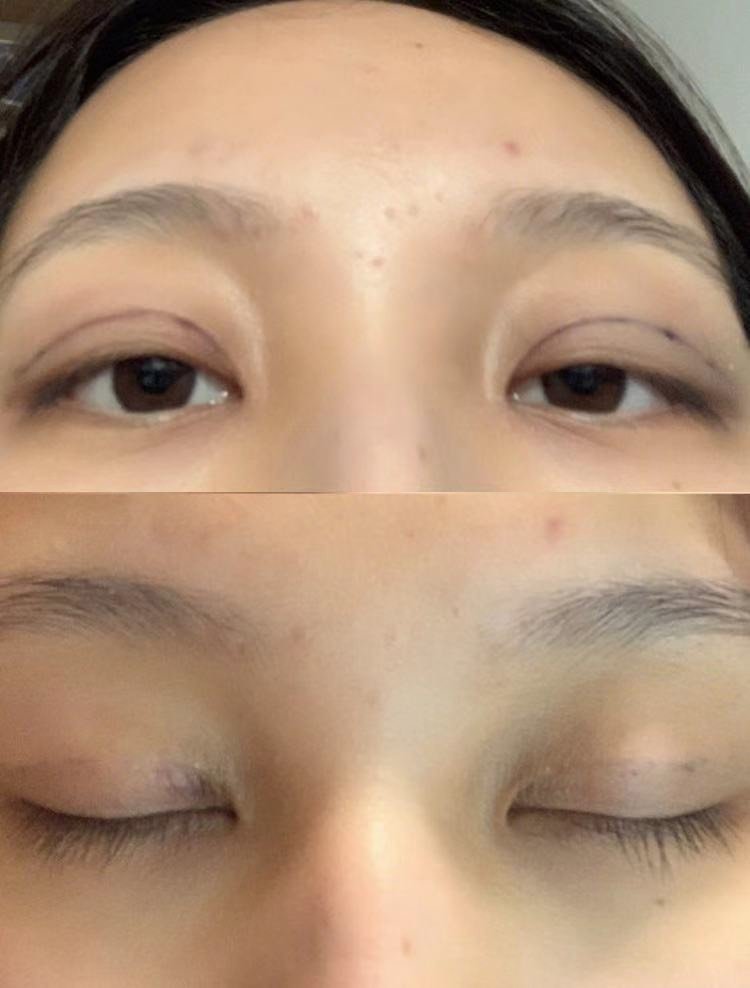 效果非常好,自然,可以说是闭眼无痕了