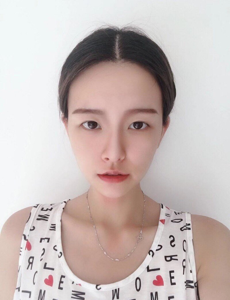 我的眼睛就是属于单眼皮,但是眼睛还算圆的哪一类,由_圈子-新氧美容