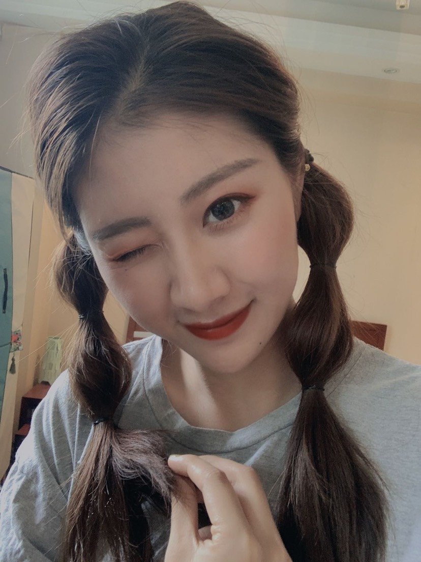 我的脸典型的北方人的脸,颧骨高颧弓宽,我比较喜欢娇_圈子-新氧美容