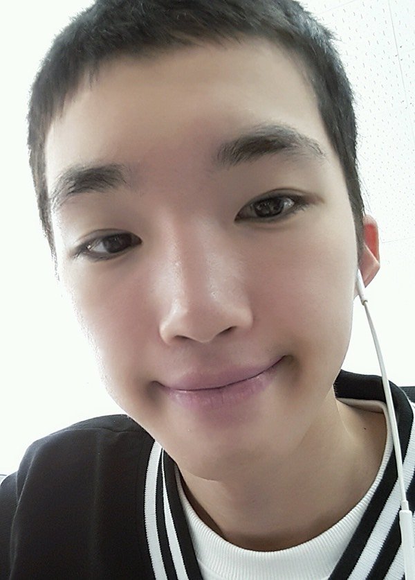 本身不喜欢太宽太明显的双眼皮,我是男生,太宽了有点奇怪.