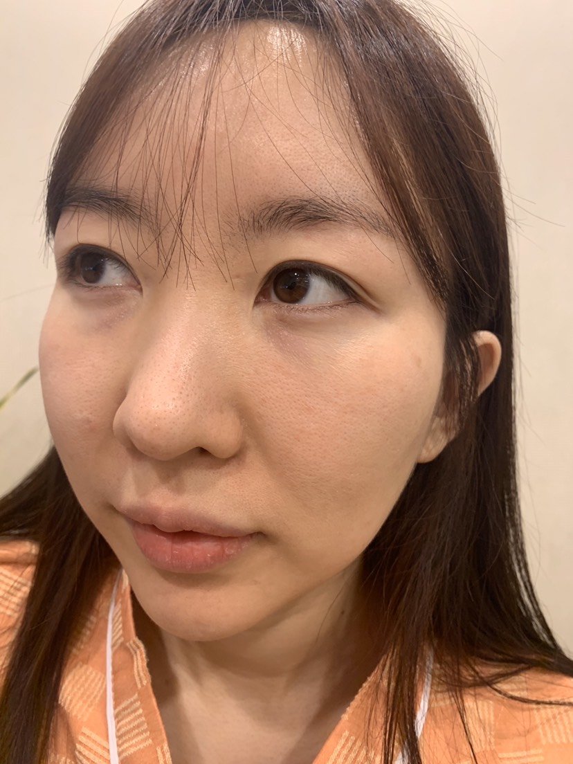 严重泪沟女孩上线!