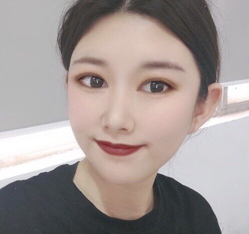 术前眼皮比较薄,并且很单,所以看起来眼睛比较狭长!
