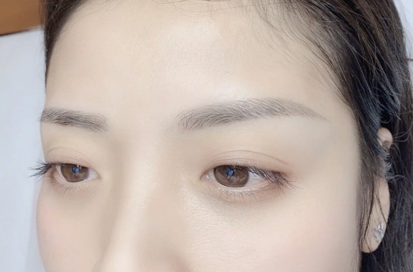 我的眉毛非常淡,平时又懒得画,这几年陆续找了好几家_圈子-新氧美容