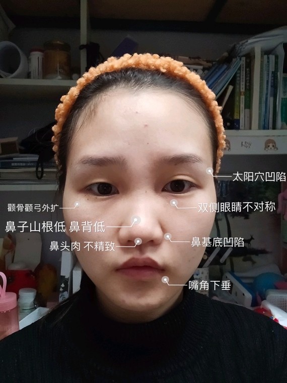 6. 嘴角有下垂趋势  会显得有苦相感