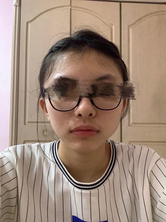 请问我的下颌的不对称要怎么办