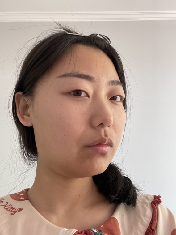 跪求氧叔看脸给凸眼女孩支招