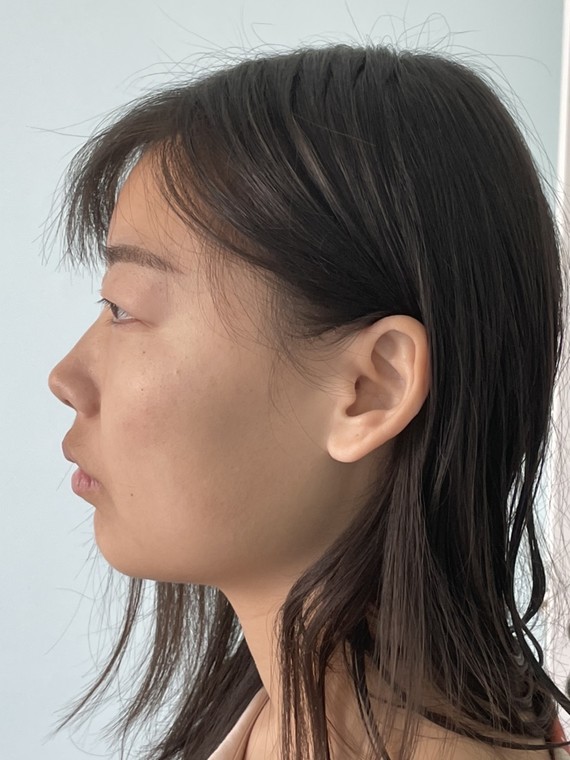 跪求氧叔看脸给凸眼女孩支招