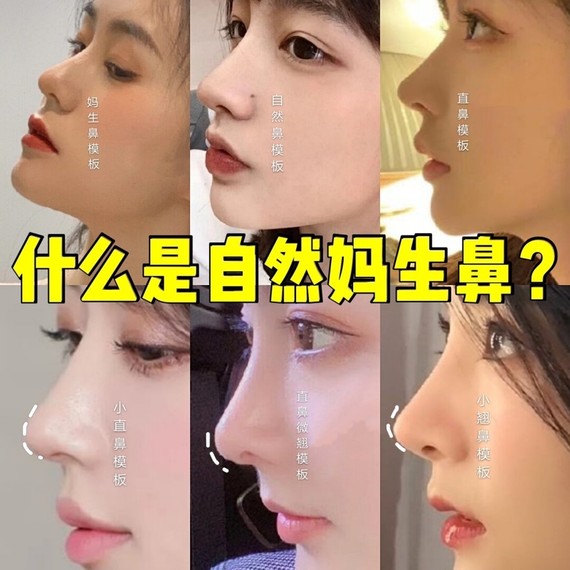 什么是自然妈生鼻71妈生鼻功课必备干货75