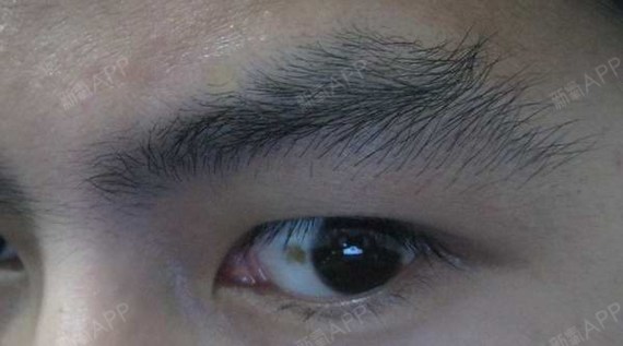 各种不好的眉形,赶快来做排除法~~散财眉接近尾部的眉毛跑较散乱,称为散财_圈子-新氧美容整形