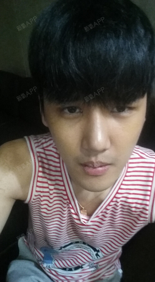 这位小帅哥!其实整形前 就不错的脸蛋~底子蛮好的