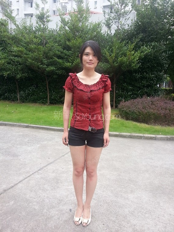 韩国jj洪镇柱整形外科医院免费整形活动 长得好看_圈子-新氧美容整形