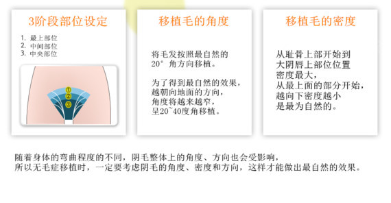 首页 此页面仅支持预览 Avatar Jj洪镇柱整形医院 1124篇日记 韩国整形 私密整形 Jj洪镇柱整形外科 女性无毛症 今天小编为大家介绍一下jj家毛发移植手术中最后一项 女性无毛症 阴毛 为您打造女性的神秘美感 女性无毛症 Public Hair 是指 阴毛是与胳