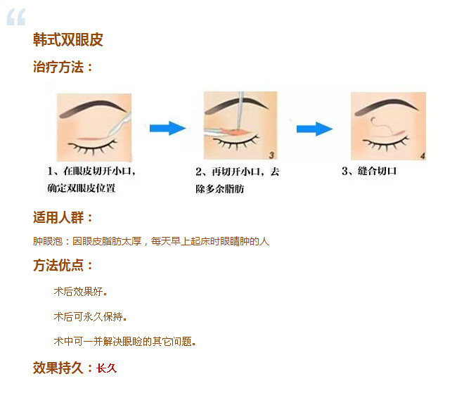 做双眼皮的五大理由,你肯定不知道!