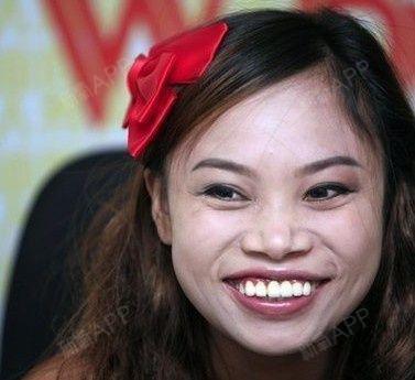 请理性地仔细看,人家还是当下流行的m唇呢,微整一下是不是还有点范爷