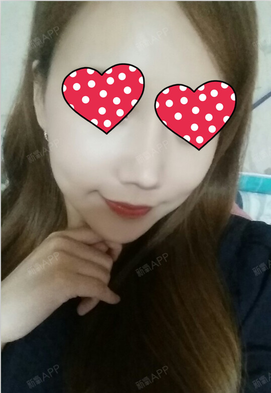 【韩国那木整形医院】圆头鼻手术真实案例!