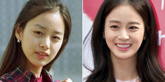 为什么韩国明星的牙齿又白又齐?为什么韩国女明星长得相似的那么多?