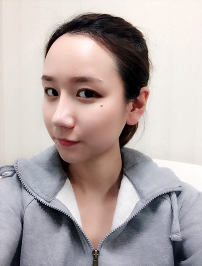 面部脂肪填充希克丽整形外科医院