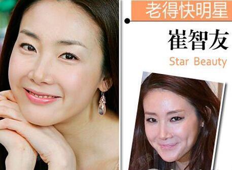 崔智友整容前后判若两人与10年前对比差别惊人我最喜 圈子 新氧美容整形
