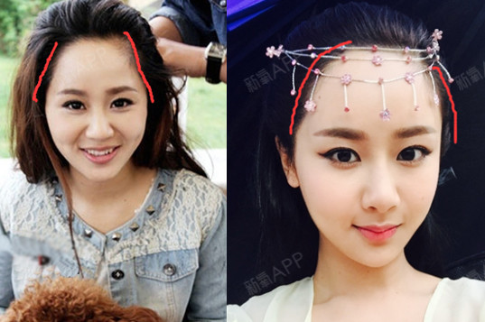 氧气奇葩脱口秀,揭秘杨紫的"变脸神功"如_圈子-新氧美容整形