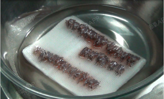 将提取的毛囊分离成若干小的移植单位