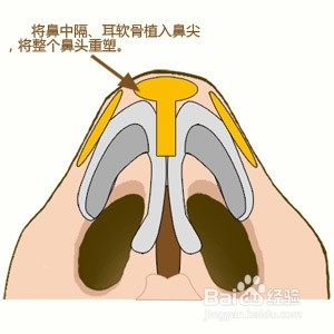 今天开更科普贴,第二篇,普啥好呢,鉴于最近好多小氧气问我耳软骨和鼻