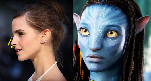 鼻修复假体选择硅胶感染率更低】上海喜美医疗美容-王会勇