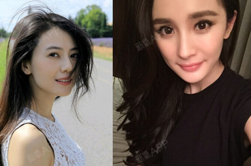 达拉斯隆鼻过程_达拉斯隆鼻和鼻综合_达拉斯综合隆鼻恢复期