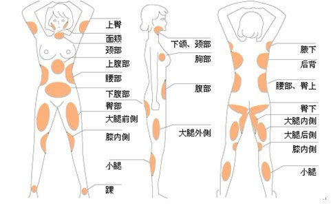 脂肪抽吸的常见部位为脂肪易堆积的部位,如腹部,腰部,臀部,大腿