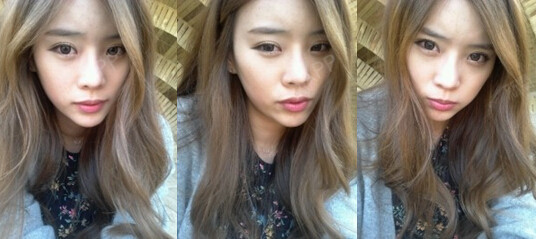 m小护士m下颌角整形第331天美丽日记