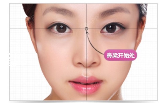 短鼻子 正常鼻背长度应占整个面部的1/3,短鼻子则小于1/3.