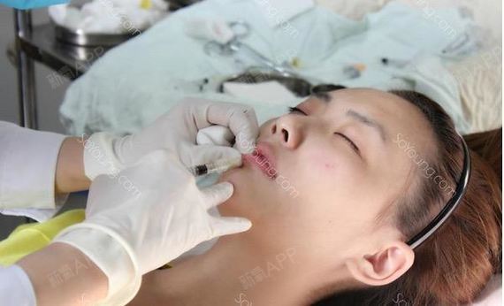 玻尿酸垫下巴好不好_效果图_取消新鲜感玻尿酸垫下巴术后第14天_新氧