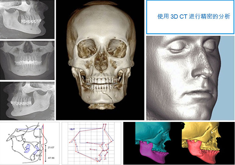 高蘭得利用 3d ct 精密診斷系統,不僅能夠對臉部的骨骼