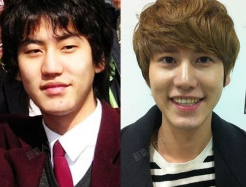 【韩国korea整形医院】爆《星星的你》金秀贤承认整容 真整了吗?