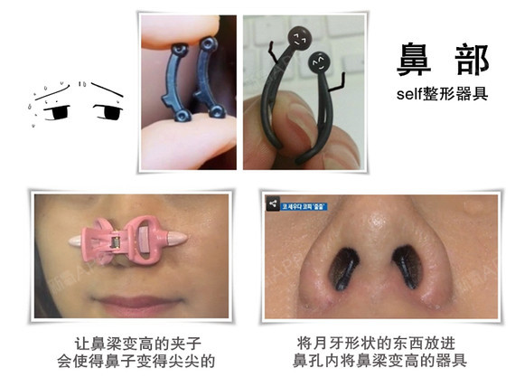 那些看起来好神奇的 迷你self整形矫正器 你都买 圈子 新氧美容整形