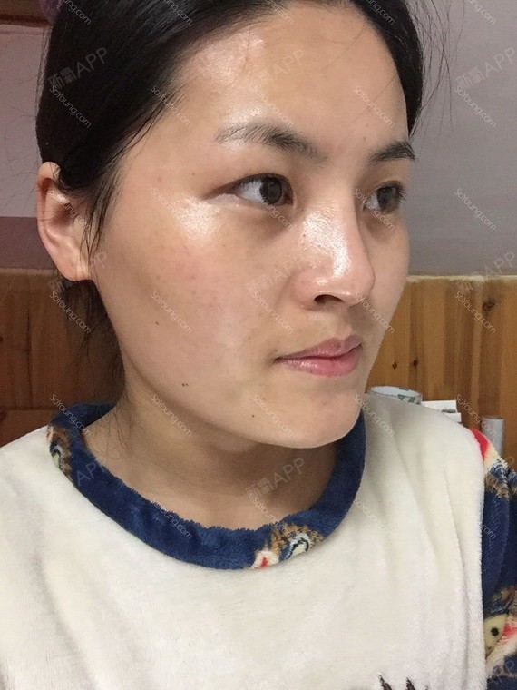 【上海余天成"打造网红"代言人】 让自己变美起来新_圈子-新氧美容