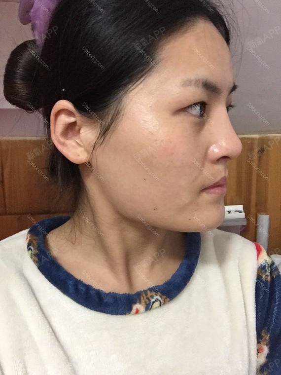 【上海余天成"打造网红"代言人】 让自己变美起来新_圈子-新氧美容