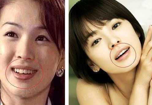 【韩国korea整形医院】35岁乔妹颜值超长待机 出道20年还是少女样