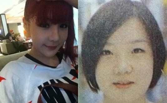 Korea韩星进化论 2ne1 朴春 整形后 圈子 新氧美容整形