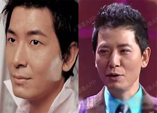 5,戴军戴军主动曝光自己步入了整容大军的行列.