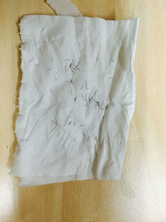 这就是我拔下来的汗毛渣渣,再看看我拔后的腋下记录图吧!