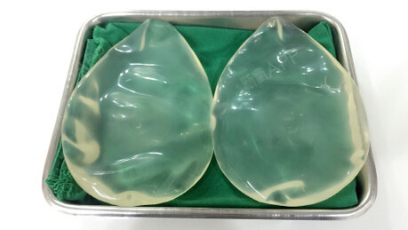 目前在韩国最普遍的方法是假体丰臀的方法,假体一般分为国产和