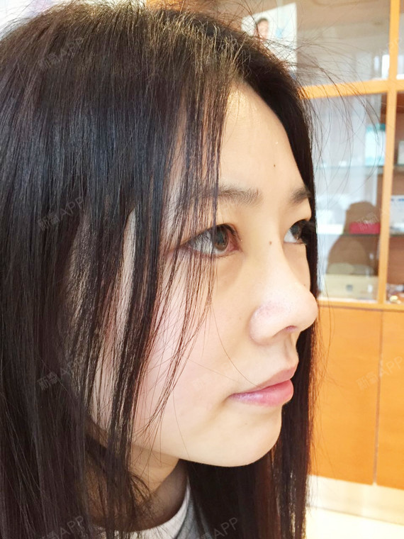 我的鼻子属于又短又朝天的类型,虽说大家多少都会露鼻孔,但是我的鼻孔