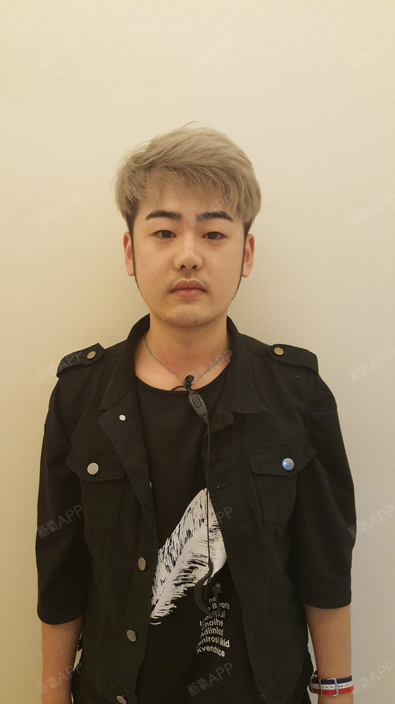 v型脸 | 肉毒素瘦脸 | 微整形 | 术后当自强 | 国内整形 | 男生瘴形