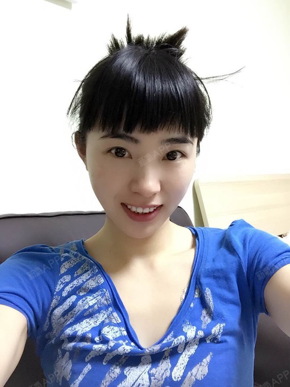 刘思雅美丽日记-新氧美容整形