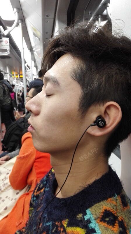 haoma玻尿酸垫下巴术后第天美丽日记_新氧整形