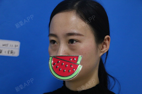 鸡皮肤打激光去眼袋(鸡皮肤打激光能治疗吗)