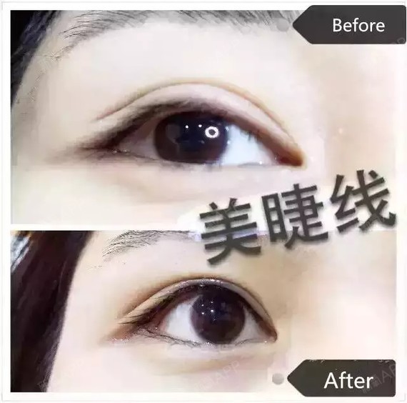 眼线,三年都能坦然相视,不怕他人笑谈眯眯眼,想变更美不妨试试美瞳线