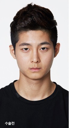 韩国整形 变成小帅哥,开始了新的人生.