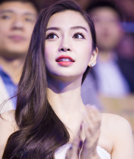 韩式芭比眼完美匹配扁平脸创伤小隐藏刀口无疤才自然武汉中爱医疗美容