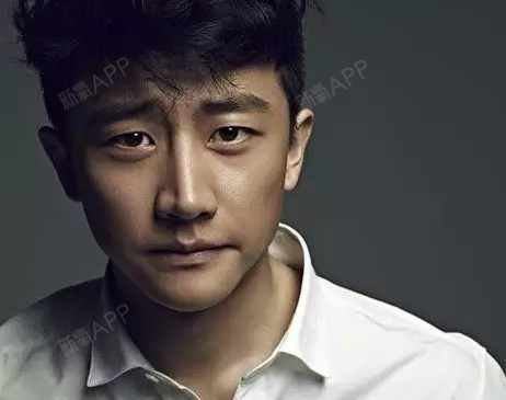 凯伦秀非切开提肌双眼皮带你来拯救死鱼眼!